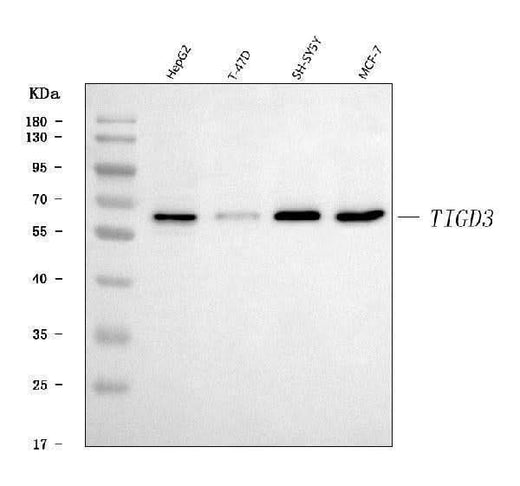Anti-TIGD3 Antibody Picoband® Boster Bio