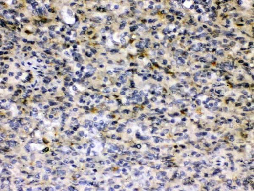 Anti-Hepatitis B Virus Antibody Picoband® Boster Bio