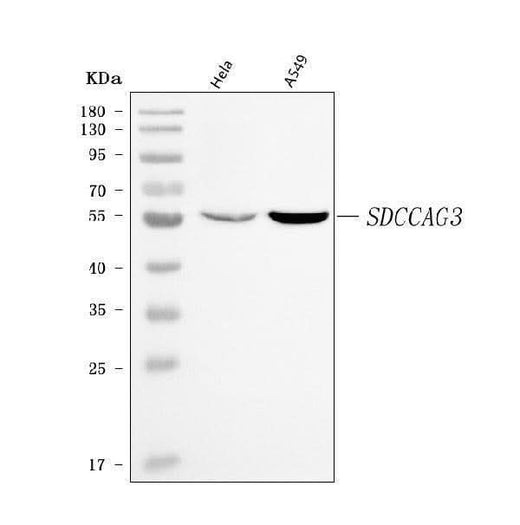 Anti-ENTR1 Antibody Picoband® Boster Bio