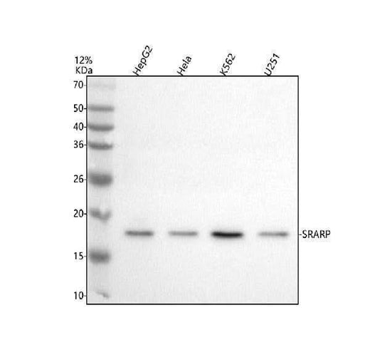 Anti-SRARP Antibody Picoband® Boster Bio