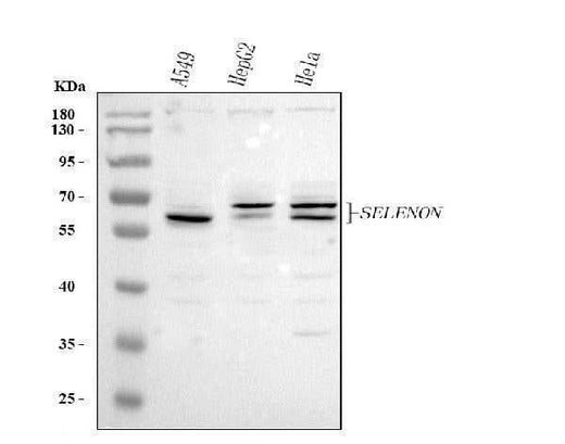 Anti-SELENON Antibody Picoband® Boster Bio
