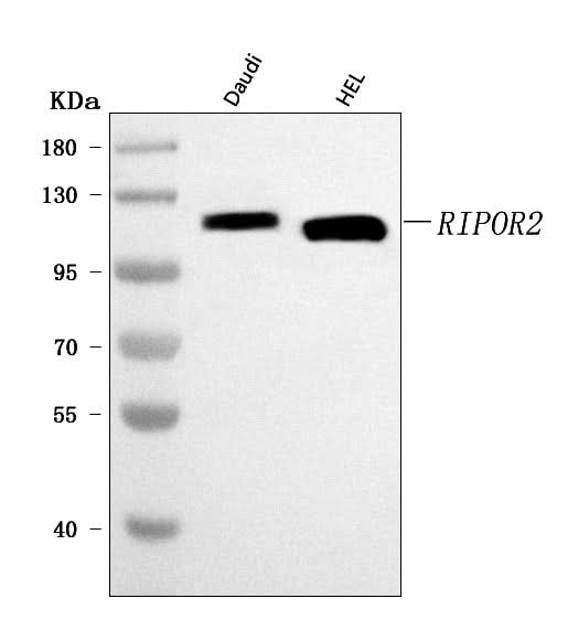 Anti-FAM65B/RIPOR2 Antibody Picoband® Boster Bio