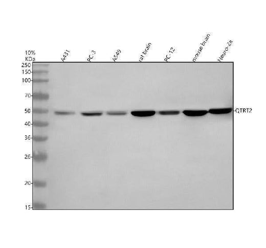 Anti-QTRT2 Antibody Picoband® Boster Bio
