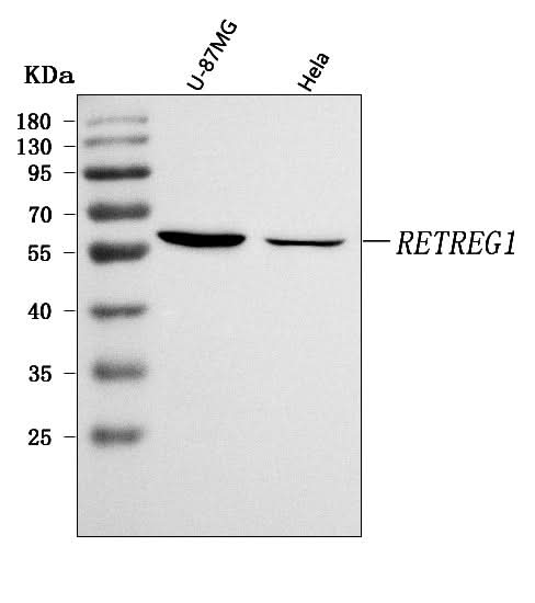 Anti-RETREG1 Antibody Picoband® Boster Bio