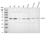 Anti-MINDY3 Antibody Picoband® Boster Bio