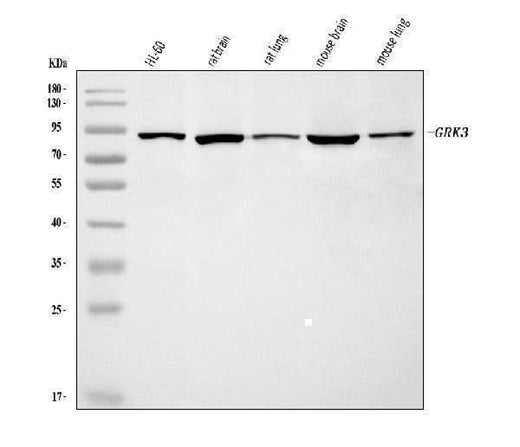 Anti-GRK3 Antibody Picoband® Boster Bio