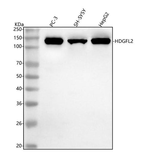 Anti-HDGFL2 Antibody Picoband® Boster Bio