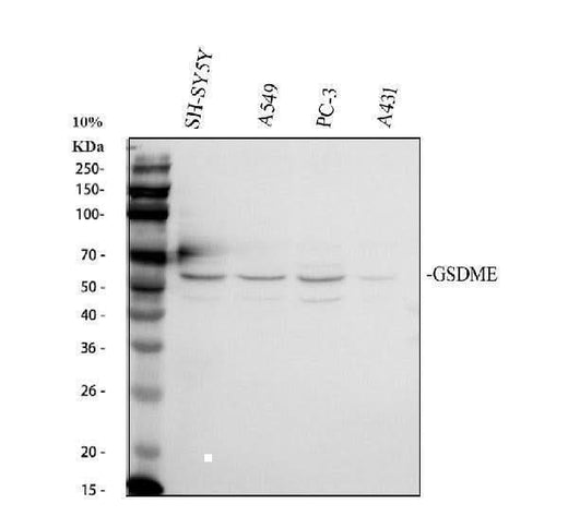 Anti-GSDME Antibody Picoband® Boster Bio