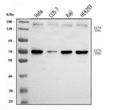 Anti-WHSC1/NSD2 Antibody Picoband® Boster Bio