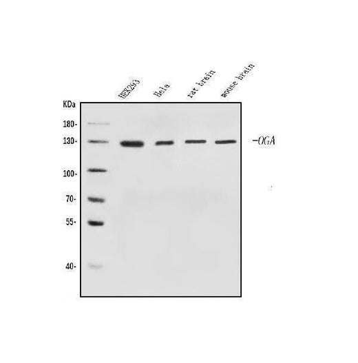 Anti-MGEA5/OGA Antibody Picoband® Boster Bio