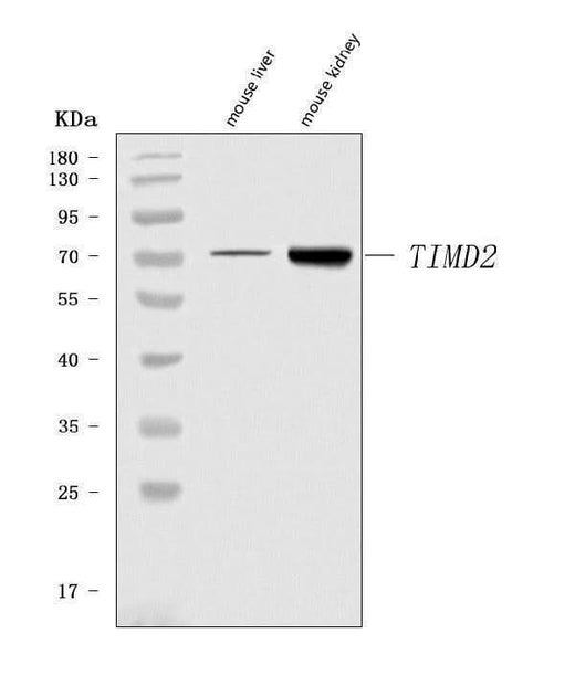 Anti-Tim 2/Timd2 Antibody Picoband® Boster Bio