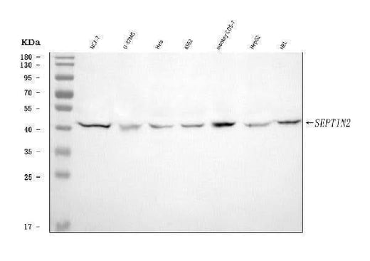 Anti-Septin 2/SEPTIN2 Antibody Picoband® Boster Bio