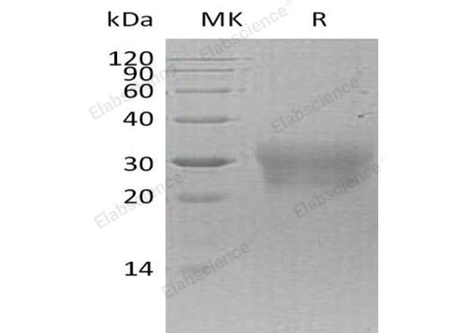 Recombinant Human NPDC-1/NPDC1 Protein (His Tag) - ABMIUM