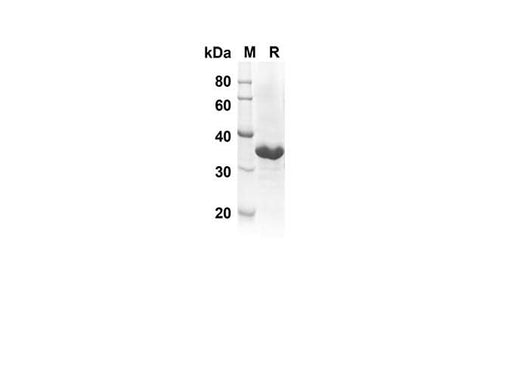 SDS-PAGE analysis of Rat IL-21 proteins, 2 μg/lane of Recombinant Rat IL-21 proteins was resolved with SDS-PAGE under reducing conditions, showing bands at 34.0 kDa.