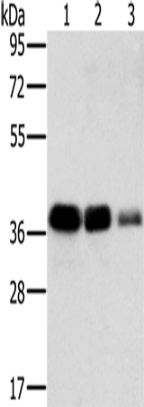 Anti-Human MTFR1 Antibody - ABMIUM