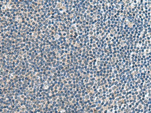 Immunohistochemistry of paraffin-embedded Human tonsil tissue using CNTN4 Polyclonal Antibody at dilution of 1:65(×200)