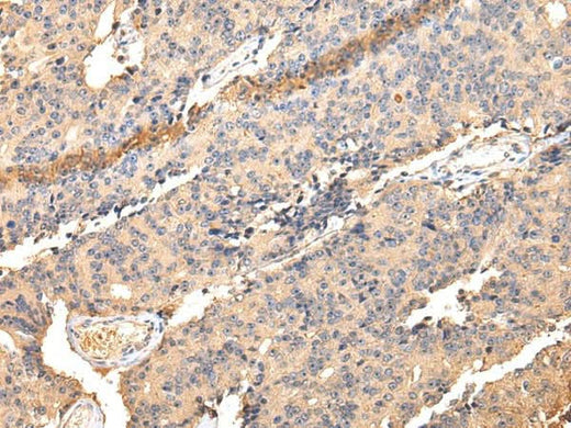 Anti-Human/Mouse/Rat SDCBP Antibody - ABMIUM