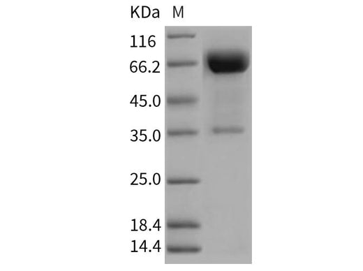 Recombinant Rat OLR1/LOX1 Protein (Fc Tag) - ABMIUM