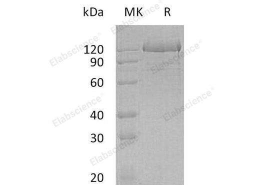 Recombinant Human Protocadherin-1/PCDH1 Protein (His Tag) - ABMIUM