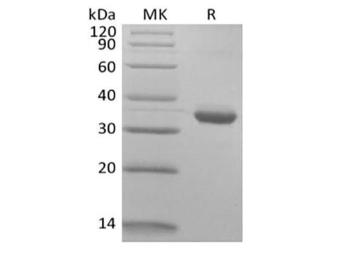 Recombinant Human IgG1 Fc Biotinylated - ABMIUM