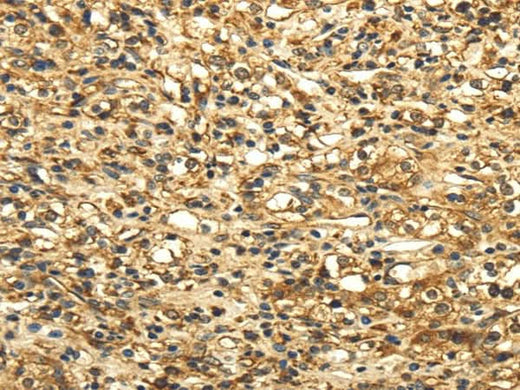 Anti-Human SLC6A19 Antibody - ABMIUM