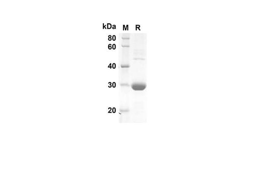SDS-PAGE analysis of Human CXCL5 proteins, 2 μg/lane of Recombinant Human CXCL5 proteins was resolved with an SDS-PAGE under reducing conditions, showing bands at 28 kDa.
