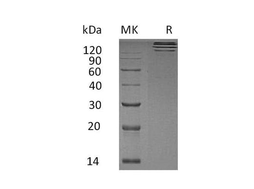 Recombinant Human TREML1/TLT-1 Protein (Fc Tag) - ABMIUM