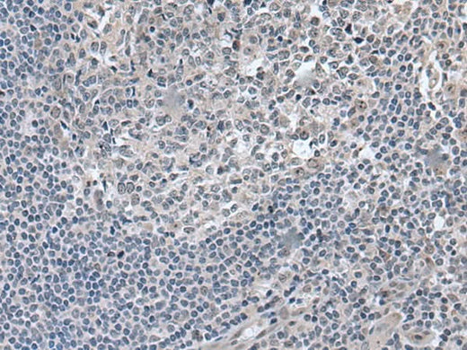 Immunohistochemistry of paraffin-embedded Human tonsil tissue using EDARADD Polyclonal Antibody at dilution of 1:50(×200)
