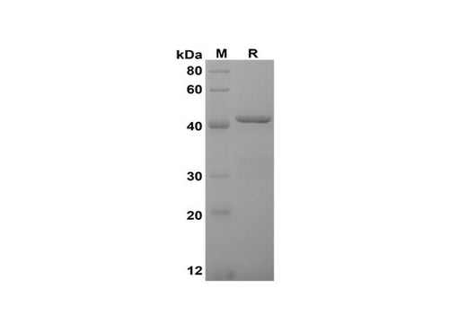 SDS-PAGE analysis of Mouse IL-16 proteins, 2 μg/lane of Recombinant Mouse IL-16 proteins was resolved with SDS-PAGE under reducing conditions, showing bands at 42 kDa.