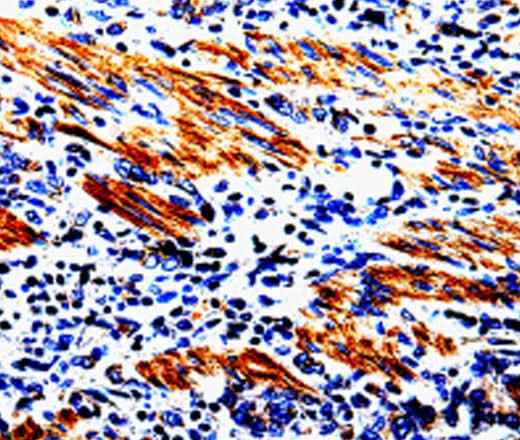 Anti-Human ACSBG2 Antibody