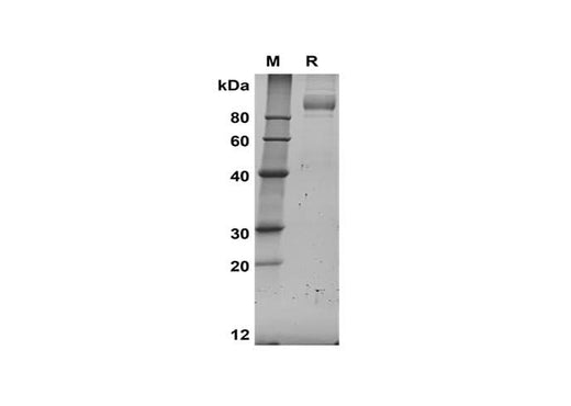 SDS-PAGE analysis of Human ACE2 proteins, 2 μg/lane of Recombinant Human ACE2 proteins was resolved with SDS-PAGE under reducing conditions, showing bands at 95-110 kDa.