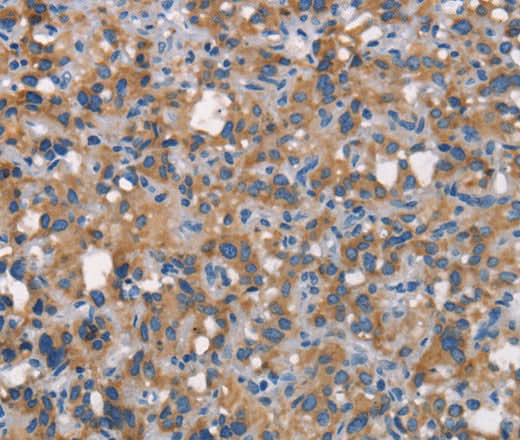 Anti-Human CEACAM6 Antibody - ABMIUM