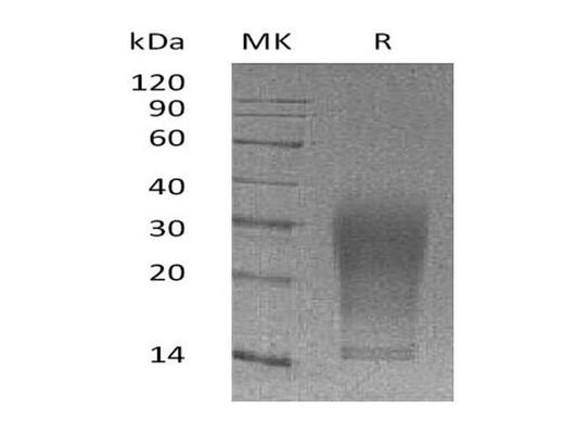 Recombinant Mouse Interleukin-13/IL-13 Protein (His Tag) - ABMIUM