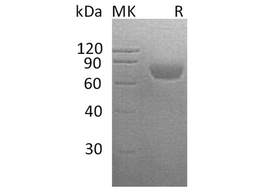 Recombinant Human CD48 Protein (His Tag) - ABMIUM
