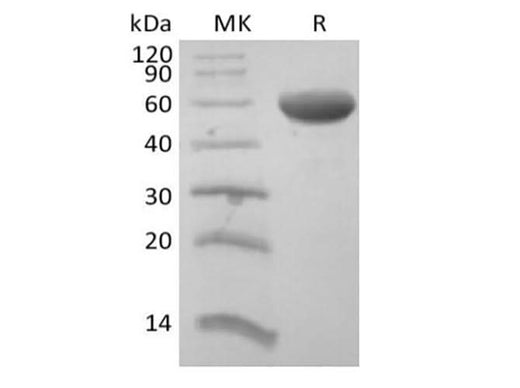 Recombinant Human CD8 Beta Chain/CD8B (C-Fc) - ABMIUM