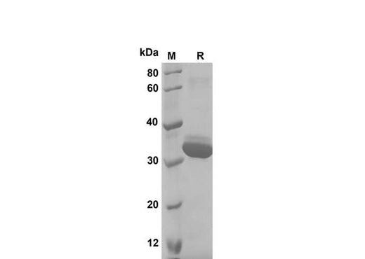 SDS-PAGE analysis of Rat Cystatin C proteins, 2 μg/lane of Recombinant Rat Cystatin C proteins was resolved with SDS-PAGE under reducing conditions, showing bands at 33 kDa.
