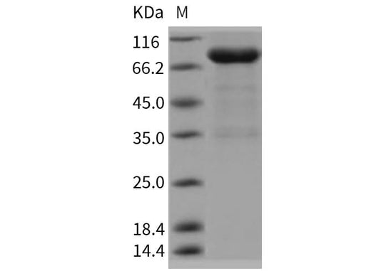 > 85 % as determined by reducing SDS-PAGE.