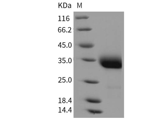 Recombinant Rat Layilin/LAYN Protein - ABMIUM