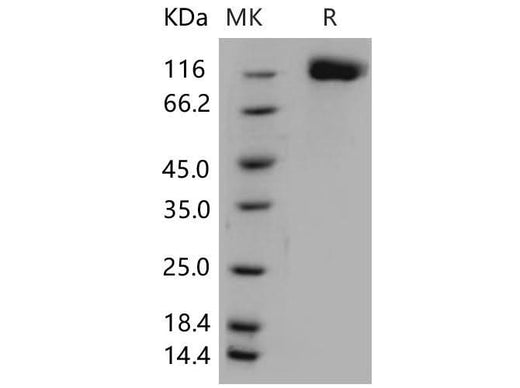 Recombinant Mouse OSMR/IL-31RB Protein (His Tag) - ABMIUM