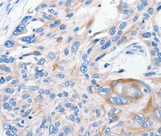 Anti-Human FANCF Antibody