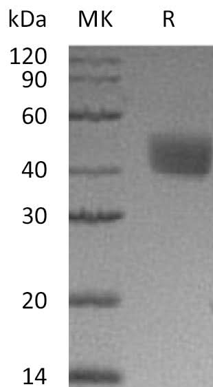 Recombinant Mouse Mesothelin/MSLN Protein (His Tag) - ABMIUM