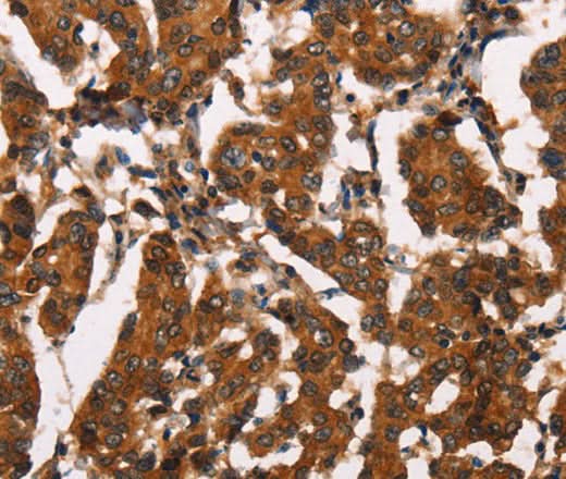 Anti-Human/Mouse/Rat ATRN Antibody - ABMIUM