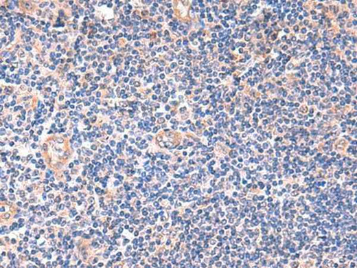 Immunohistochemistry of paraffin-embedded Human tonsil tissue using ZNF256 Polyclonal Antibody at dilution of 1:120(×200)