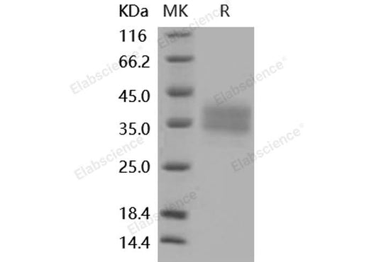 > 98 % as determined by reducing SDS-PAGE.
