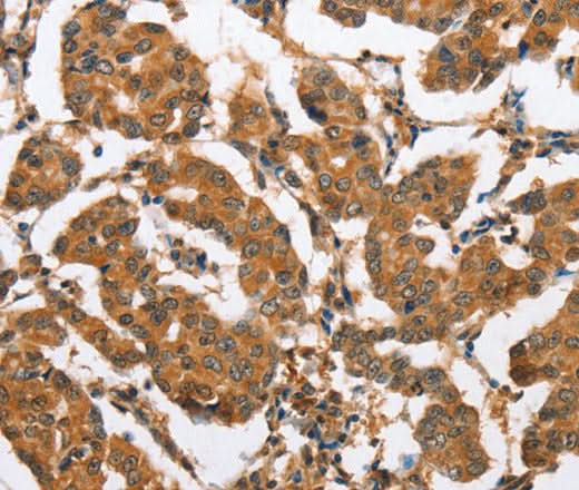 Anti-Human CXCL14 Antibody - ABMIUM