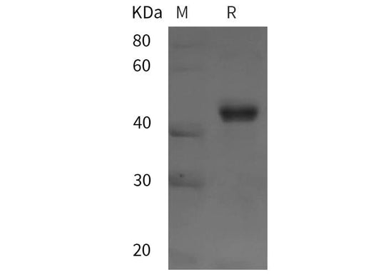 SDS-PAGE analysis of Human PPM1A proteins, 2 μg/lane of Recombinant Human PPM1A proteins was resolved with SDS-PAGE under reducing conditions, showing bands at 45 kDa.