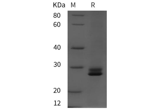 SDS-PAGE analysis of Rat ACE proteins, 2 μg/lane of Recombinant Rat ACE proteins was resolved with SDS-PAGE under reducing conditions, showing bands at 28 kDa.