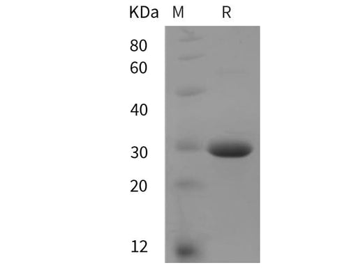 SDS-PAGE analysis of Rat ANG2 proteins, 2 μg/lane of Recombinant Rat ANG2 proteins was resolved with SDS-PAGE under reducing conditions, showing bands at 30 kDa.