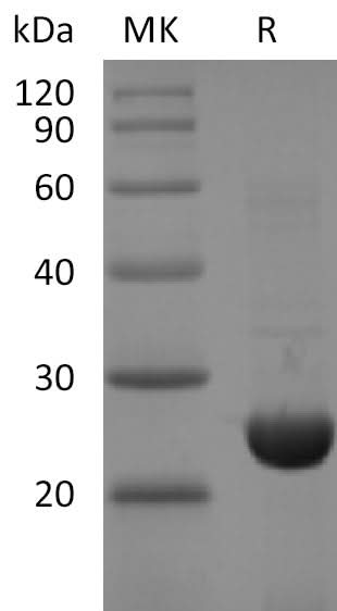 Recombinant SARS-CoV-2 NSP8 Protein (His Tag) - ABMIUM