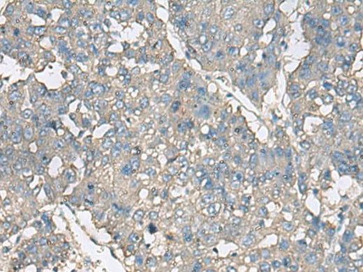 Anti-Human/Mouse/Rat TNF Antibody